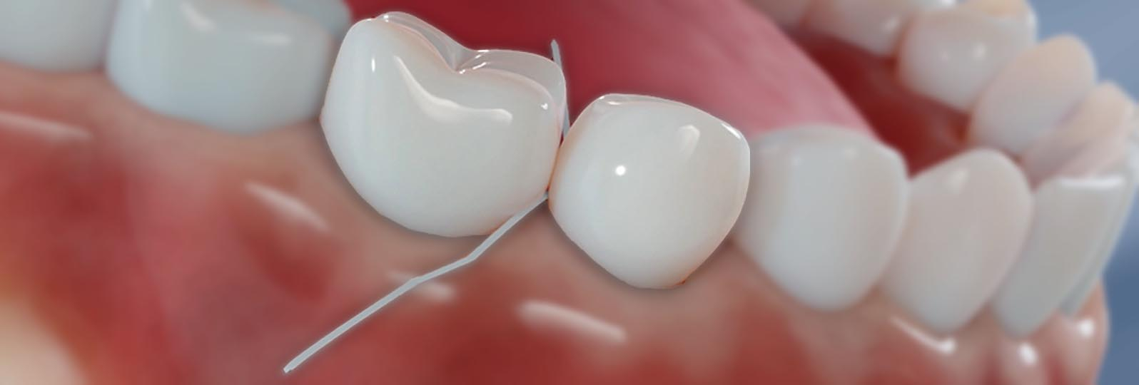 Floss Meaning Incache Beyond Brushing: How to Floss with Proper Technique - Denton Dental Group